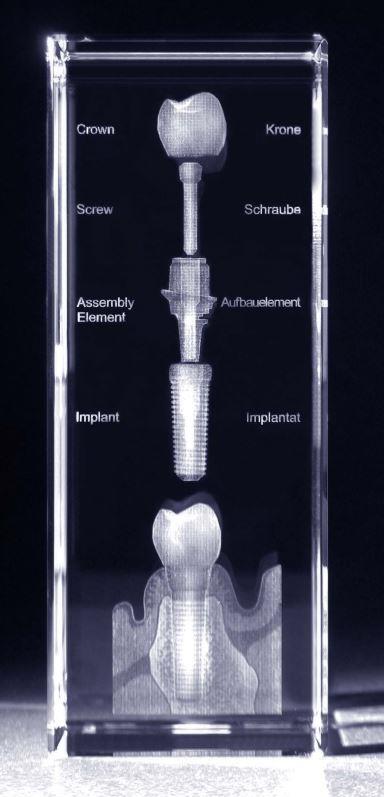 3-D Kristall Motiv: Implantataufbau im Querschnitt mit Beschriftung  Maße: 130x50x50mm