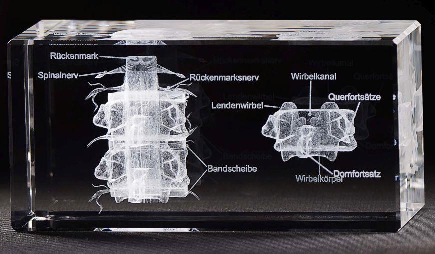 3-D Kristall Motiv: Wirbel mit Rückenmark  im Querschnitt mit Beschriftung  Maße: 160x80x80mm