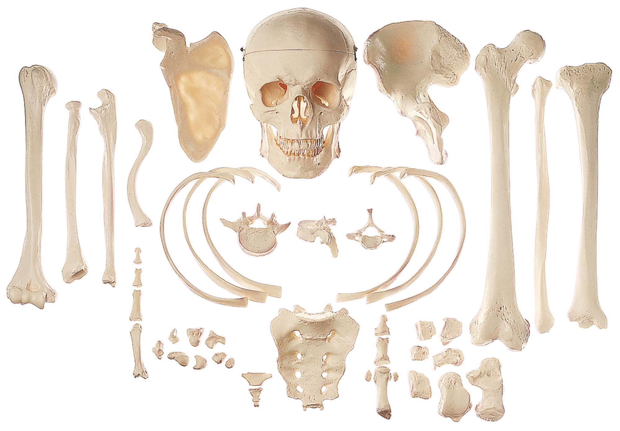 Sammlung typischer Knochen vom Menschen - Somso
